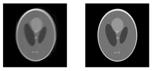 Motion affected Shepp-Logan head phantom (left) and corrected version using TRELLIS (right)